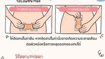 วิธีติดแผ่น Atofine Surgical Scar Care Tape